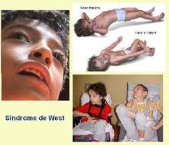 Día Mundial del Síndrome de West.jpg