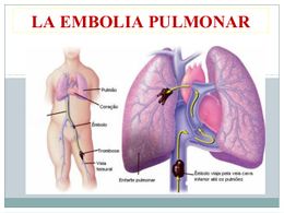 Dolor-toracico-gianmarco-guzman-castillo-000066665-34-638.jpg