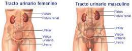 Hipersensibilidad-e-infección-del-tracto-urinario.jpg