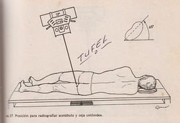 Posición para radiografiar acetábulo y ceja cotiloidea.jpg