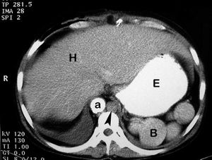 Poliesplenia fig01.jpg