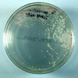 Hongo-geotrichum-candidum.jpg