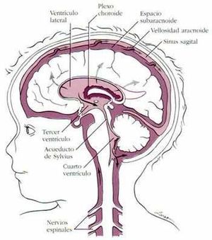 Edema cerebral.jpg