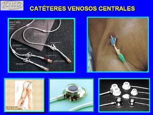 Catéteres venosos centrales.JPG